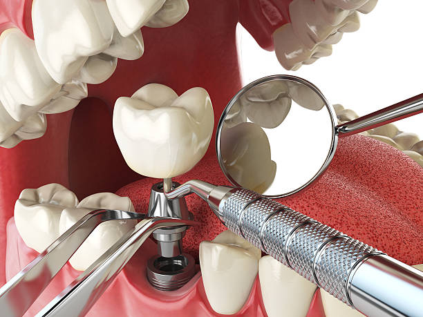 Best Emergency Cosmetic Dentistry (e.g., broken veneers) in New Cumberland, WV